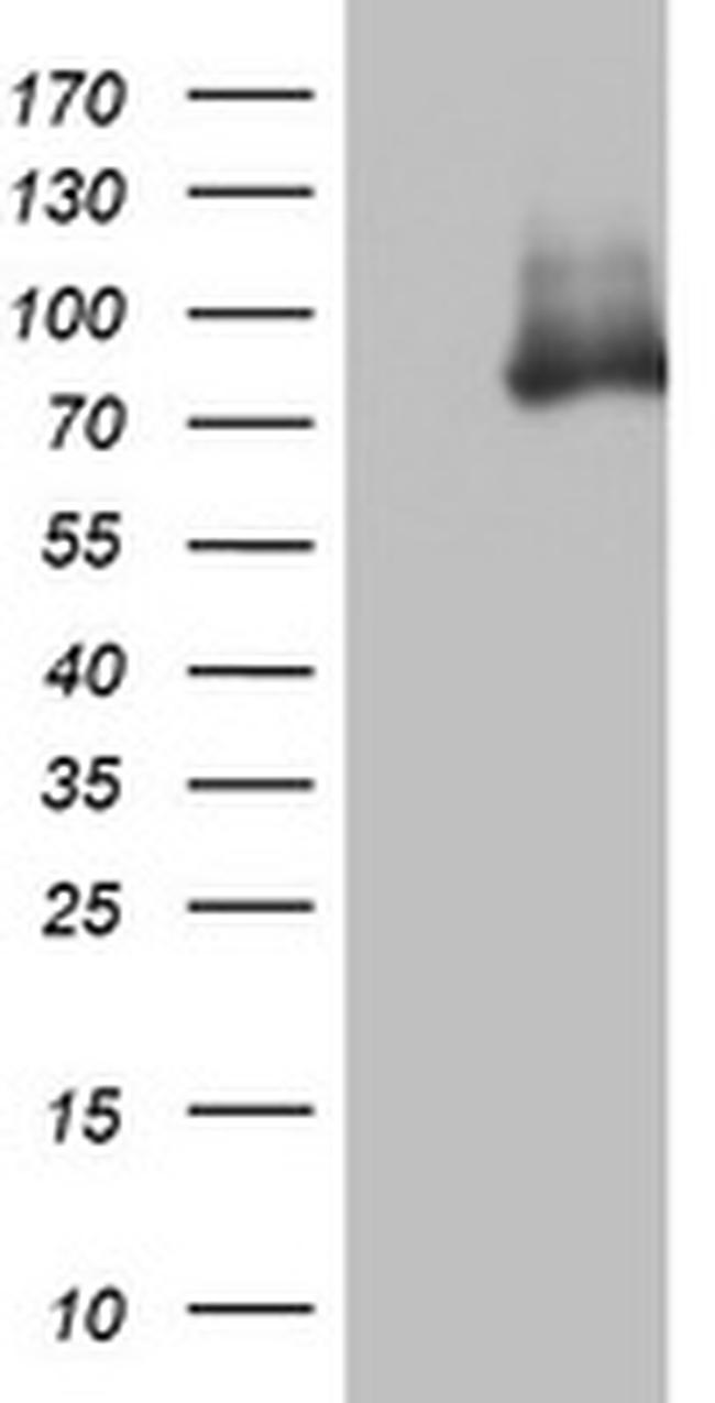 OAS2 Antibody in Western Blot (WB)