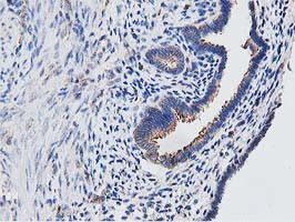 OGFOD1 Antibody in Immunohistochemistry (Paraffin) (IHC (P))