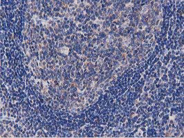 OGFOD1 Antibody in Immunohistochemistry (Paraffin) (IHC (P))