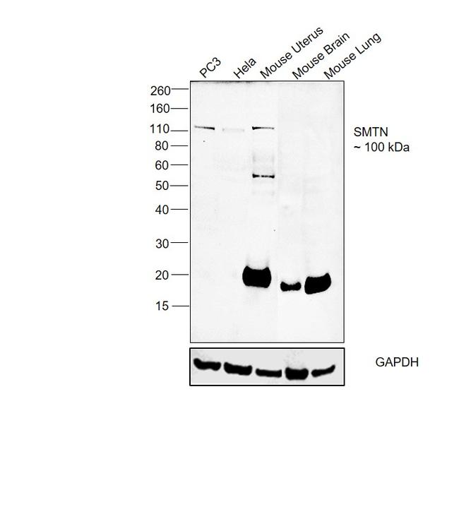 Smoothelin Antibody in Western Blot (WB)