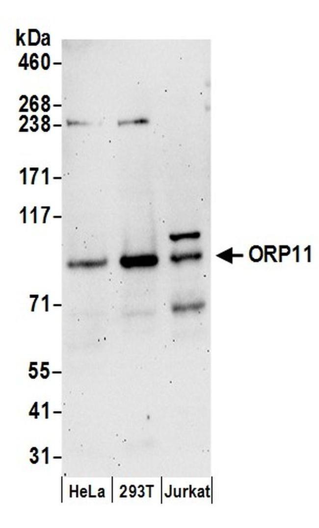 ORP11 Antibody in Western Blot (WB)