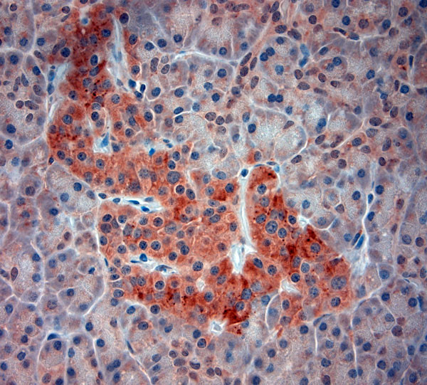 ATG4D Antibody in Immunohistochemistry (Paraffin) (IHC (P))