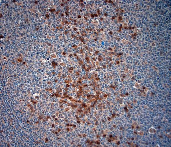 ATG4D Antibody in Immunohistochemistry (Paraffin) (IHC (P))