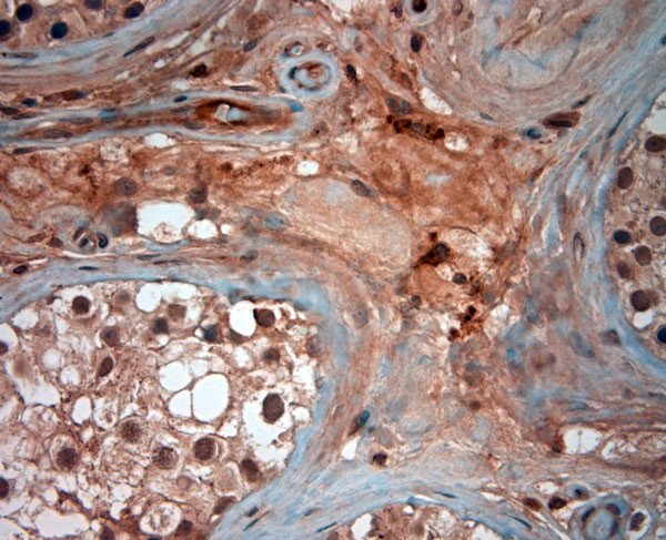 ATG4D Antibody in Immunohistochemistry (Paraffin) (IHC (P))