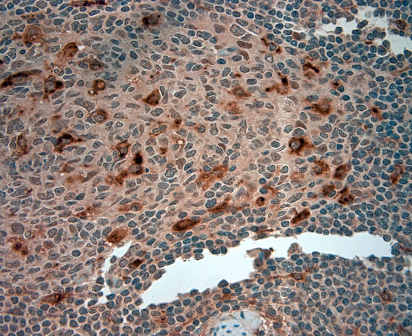 ATG4D Antibody in Immunohistochemistry (Paraffin) (IHC (P))