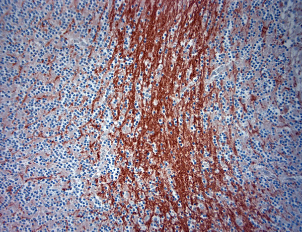 ATG4D Antibody in Immunohistochemistry (Paraffin) (IHC (P))