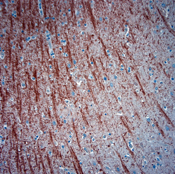 ATG4D Antibody in Immunohistochemistry (Paraffin) (IHC (P))