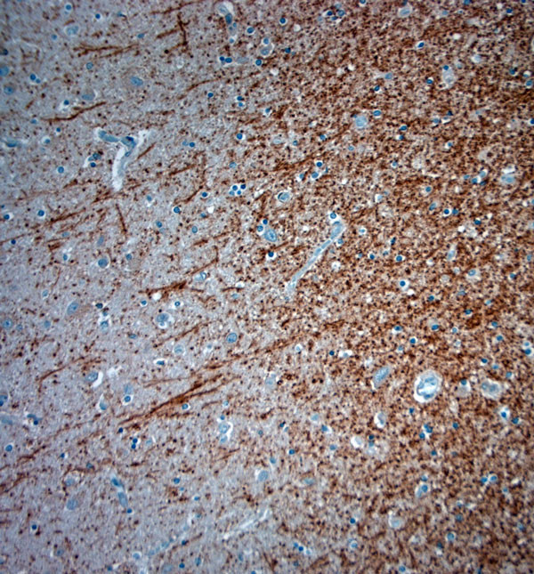 ATG4D Antibody in Immunohistochemistry (Paraffin) (IHC (P))