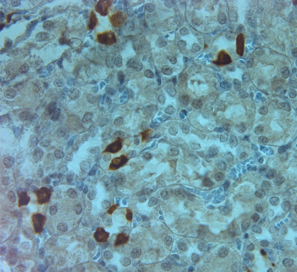 AQP6 Antibody in Immunohistochemistry (Paraffin) (IHC (P))