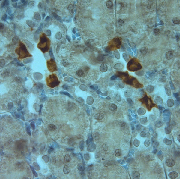 AQP6 Antibody in Immunohistochemistry (Paraffin) (IHC (P))