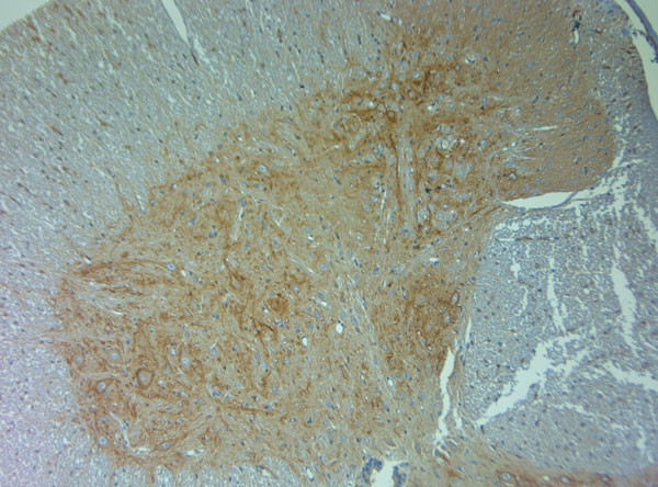 Aggrecan Antibody in Immunohistochemistry (Paraffin) (IHC (P))