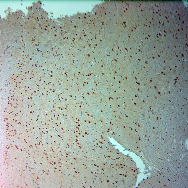 ARX Antibody in Immunohistochemistry (Paraffin) (IHC (P))