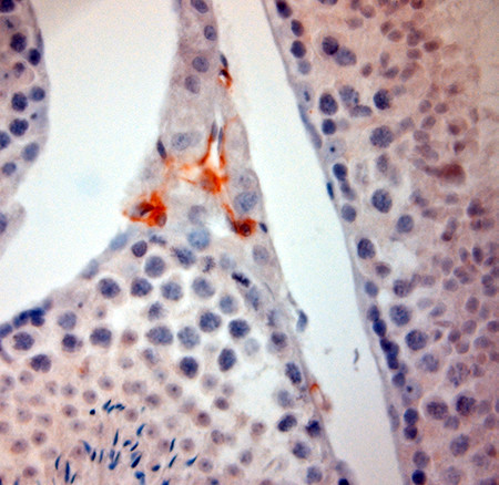 ACE2 Antibody in Immunohistochemistry (Paraffin) (IHC (P))