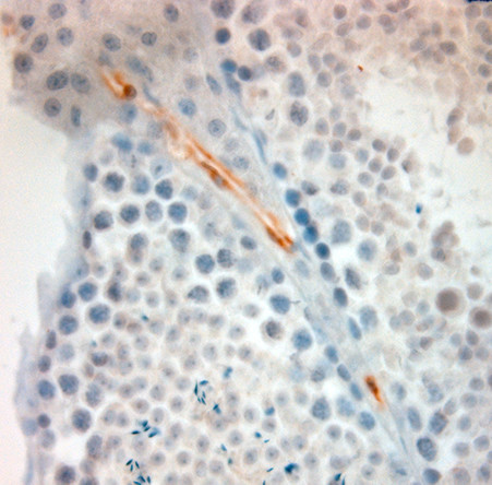 ACE2 Antibody in Immunohistochemistry (Paraffin) (IHC (P))