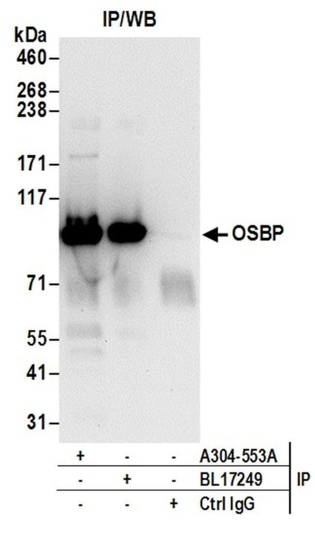 OSBP Antibody in Immunoprecipitation (IP)