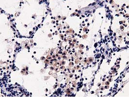 OSBPL11 Antibody in Immunohistochemistry (Paraffin) (IHC (P))