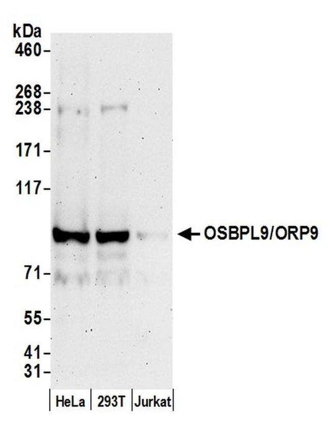 OSBPL9/ORP9 Antibody in Western Blot (WB)