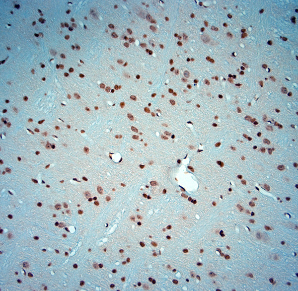 c-Fos Antibody in Immunohistochemistry (Paraffin) (IHC (P))