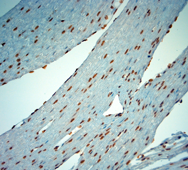 c-Fos Antibody in Immunohistochemistry (Paraffin) (IHC (P))