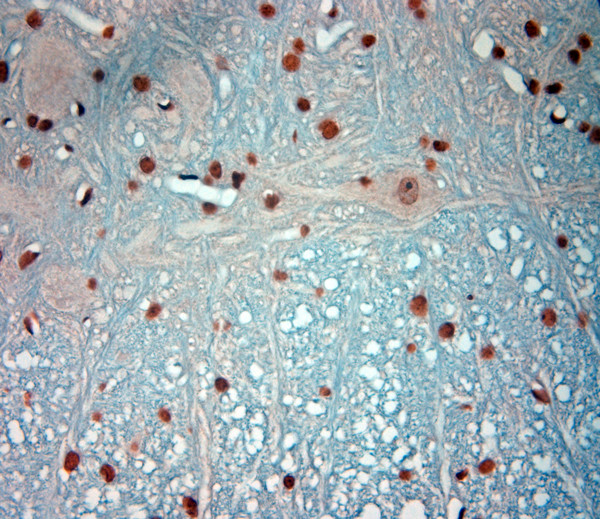 c-Fos Antibody in Immunohistochemistry (Paraffin) (IHC (P))