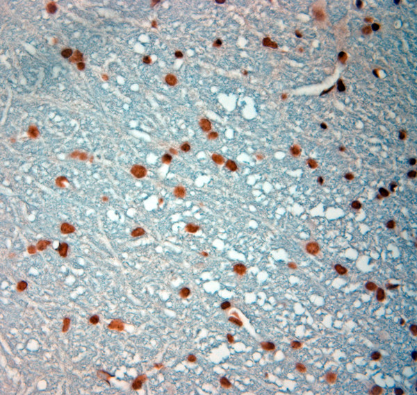 c-Fos Antibody in Immunohistochemistry (Paraffin) (IHC (P))