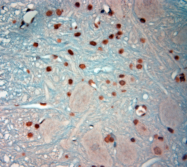 c-Fos Antibody in Immunohistochemistry (Paraffin) (IHC (P))