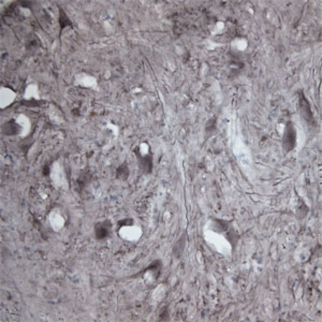 CACNA1I Antibody in Immunohistochemistry - Free Floating (IHC (Free))