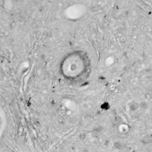 CACNA1I Antibody in Immunohistochemistry (Paraffin) (IHC (P))