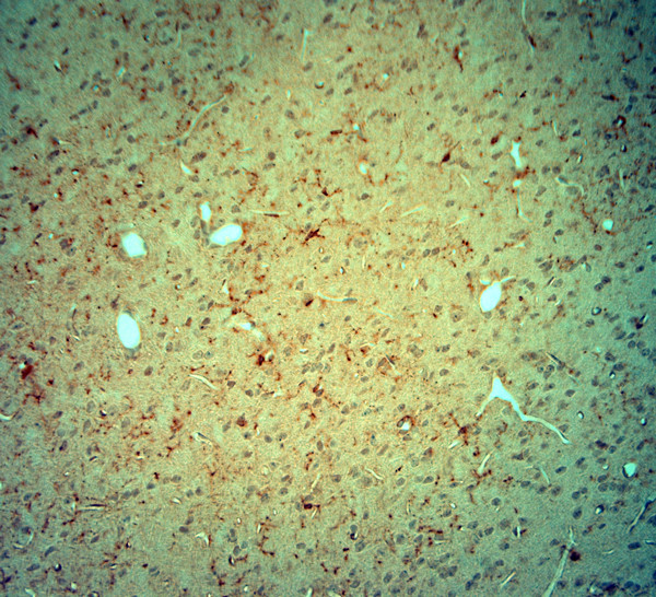 CACNA2D3 Antibody in Immunohistochemistry (Paraffin) (IHC (P))