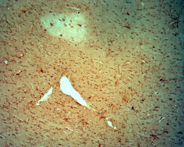 CACNA2D3 Antibody in Immunohistochemistry (Paraffin) (IHC (P))