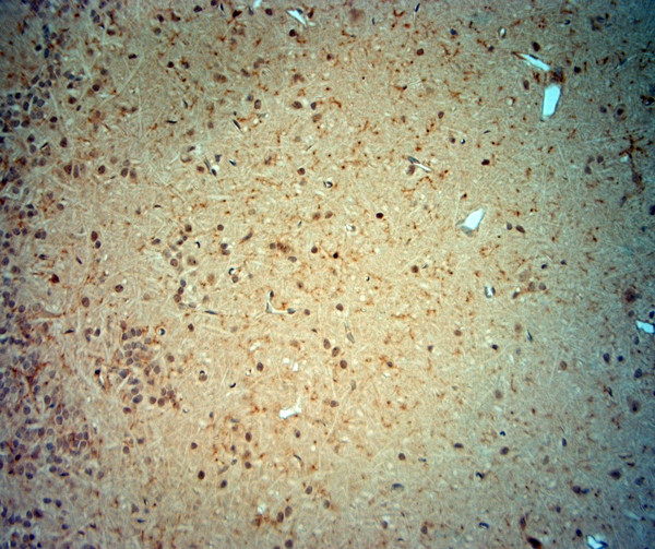 CACNA2D3 Antibody in Immunohistochemistry (Paraffin) (IHC (P))