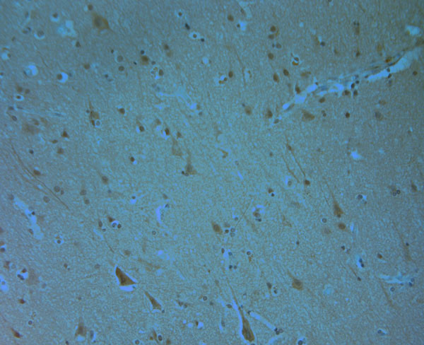 Phospho-ERK1/2 (Thr202, Tyr204) Antibody in Immunohistochemistry (Paraffin) (IHC (P))