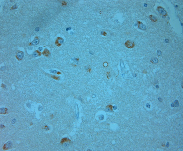 Phospho-ERK1/2 (Thr202, Tyr204) Antibody in Immunohistochemistry (Paraffin) (IHC (P))