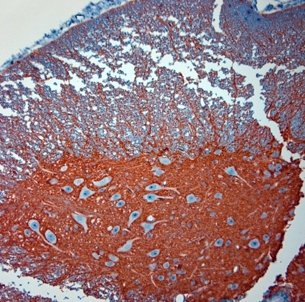 SLC1A2 Antibody in Immunohistochemistry (Paraffin) (IHC (P))