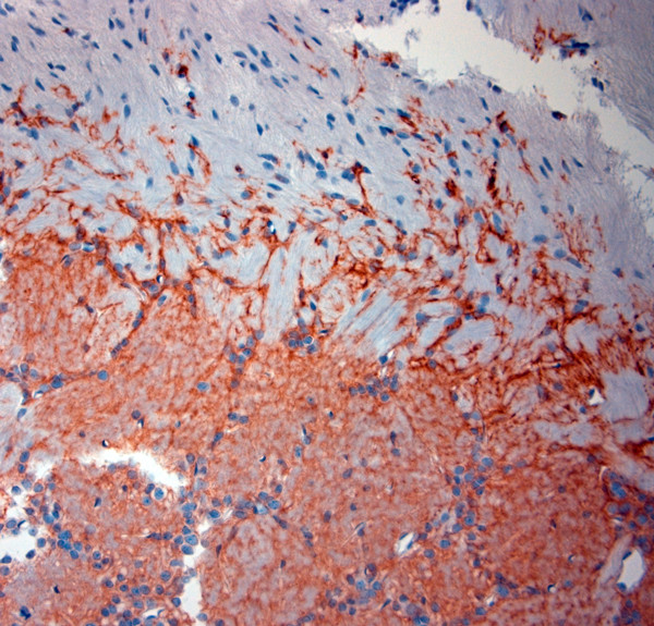 SLC1A2 Antibody in Immunohistochemistry (Paraffin) (IHC (P))