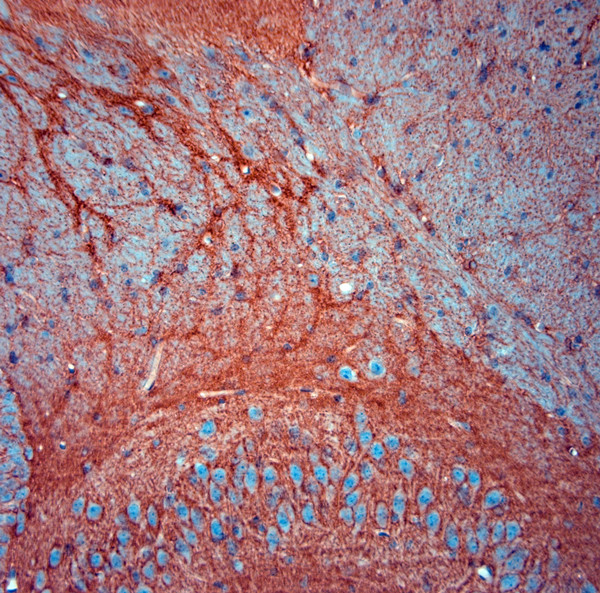 SLC1A2 Antibody in Immunohistochemistry (Paraffin) (IHC (P))