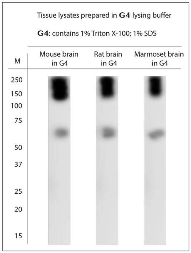 SLC1A2 Antibody in Western Blot (WB)