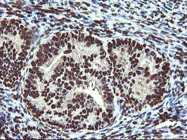 OSGEP Antibody in Immunohistochemistry (Paraffin) (IHC (P))