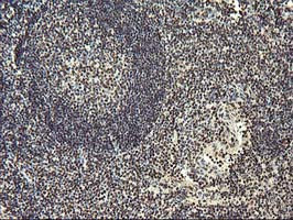 OSGEP Antibody in Immunohistochemistry (Paraffin) (IHC (P))