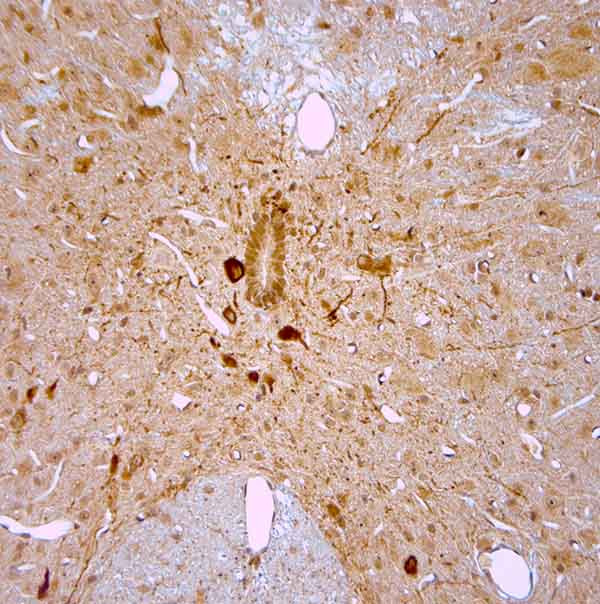 nNOS Antibody in Immunohistochemistry (Paraffin) (IHC (P))