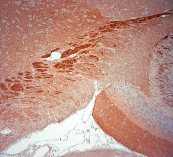 HCN1 Antibody in Immunohistochemistry (Paraffin) (IHC (P))