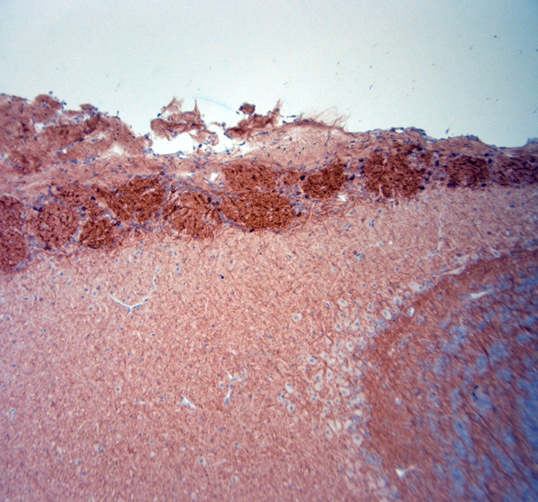 HCN1 Antibody in Immunohistochemistry (Paraffin) (IHC (P))