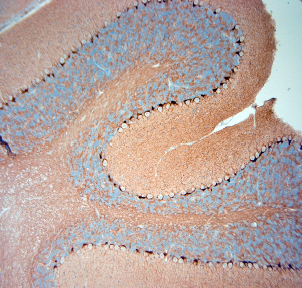 HCN1 Antibody in Immunohistochemistry (Paraffin) (IHC (P))