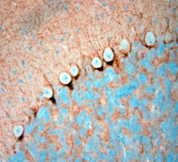 HCN1 Antibody in Immunohistochemistry (Paraffin) (IHC (P))