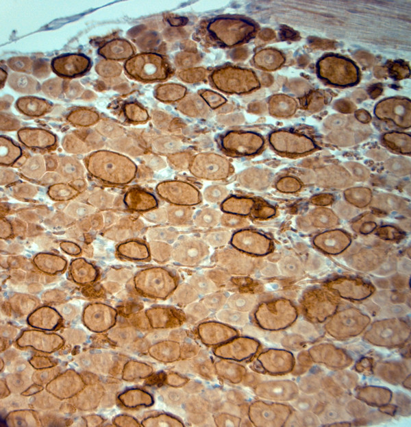 HCN1 Antibody in Immunohistochemistry (Paraffin) (IHC (P))