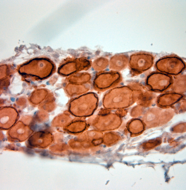 HCN1 Antibody in Immunohistochemistry (Paraffin) (IHC (P))