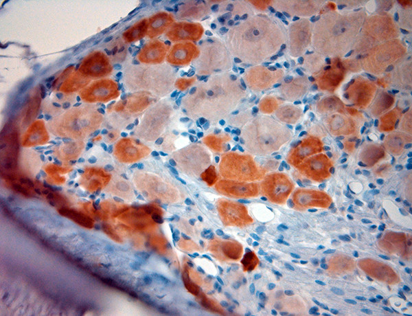 TRPV1 Antibody in Immunohistochemistry (Paraffin) (IHC (P))