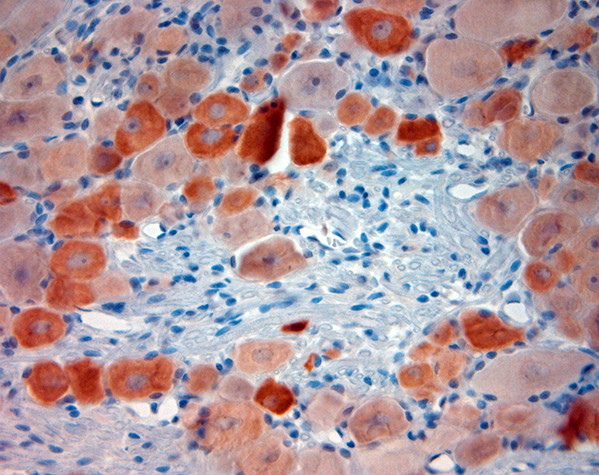 TRPV1 Antibody in Immunohistochemistry (Paraffin) (IHC (P))