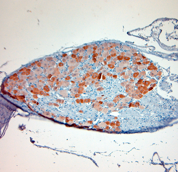 TRPV1 Antibody in Immunohistochemistry (Paraffin) (IHC (P))