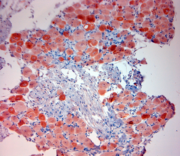 TRPV1 Antibody in Immunohistochemistry (Paraffin) (IHC (P))